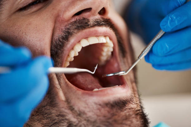 Best Emergency Pediatric Dental Care in Rye Brook, NY